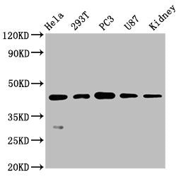 Western Blot | Positive WB detected in: Hela whole cell lysate, 293T whole cell lysate, PC3 whole cell lysate, U87 whole cell lysate, Mouse kidney tissue | All lanes: NDRG1 antibody at 0.7μg/ml | Secondary | Goat polyclonal to rabbit IgG at 1/50000 dilution | Predicted band size: 43, 36, 34 KDa | Observed band size: 43 KDaNDRG1 Recombinant Monoclonal Antibody