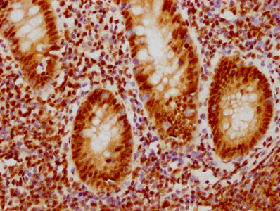 IHC image of CDC5L Recombinant Monoclonal Antibody diluted at 1:126.5 and staining in paraffin-embedded human appendix tissue performed on a Leica BondTM system. After dewaxing and hydration, antigen retrieval was mediated by high pressure in a citrate buffer (pH 6.0). Section was blocked with 10% normal goat serum 30min at RT. Then primary antibody (1% BSA) was incubated at 4℃ overnight. The primary is detected by a biotinylated secondary antibody and visualized using an HRP conjugated SP system.