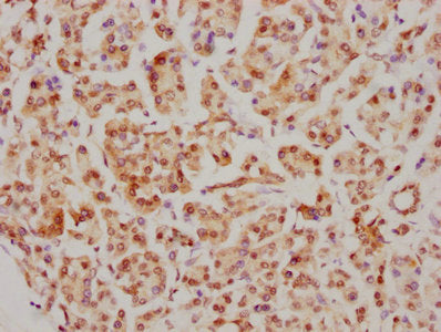 IHC image of CDC5L Recombinant Monoclonal Antibody diluted at 1:126.5 and staining in paraffin-embedded human pancreatic tissue performed on a Leica BondTM system. After dewaxing and hydration, antigen retrieval was mediated by high pressure in a citrate buffer (pH 6.0). Section was blocked with 10% normal goat serum 30min at RT. Then primary antibody (1% BSA) was incubated at 4℃ overnight. The primary is detected by a biotinylated secondary antibody and visualized using an HRP conjugated SP system.