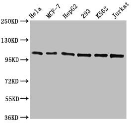 Western Blot | Positive WB detected in: Hela whole cell lysate, MCF-7 whole cell lysate, HepG2 whole cell lysate, 293 whole cell lysate, K562 whole cell lysate, Jurkat whole cell lysate | All lanes: CDC5L antibody at 1.3μg/ml | Secondary | Goat polyclonal to rabbit IgG at 1/50000 dilution | Predicted band size: 93 KDa | Observed band size: 100 KDa
