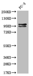 Western Blot | Positive WB detected in: Hela whole cell lysate | All lanes: KIFAP3 antibody at 1:2000 | Secondary | Goat polyclonal to rabbit IgG at 1/50000 dilution | Predicted band size: 92, 87, 83 kDa | Observed band size: 72-95 kDaKIFAP3 Recombinant Monoclonal Antibody