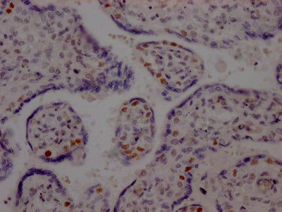 IHC image of LIG1 Recombinant Monoclonal Antibody diluted at 1:100 and staining in paraffin-embedded human placenta tissue performed on a Leica BondTM system. After dewaxing and hydration, antigen retrieval was mediated by high pressure in a citrate buffer (pH 6.0). Section was blocked with 10% normal goat serum 30min at RT. Then primary antibody (1% BSA) was incubated at 4℃ overnight. The primary is detected by a Goat anti-rabbit IgG polymer labeled by HRP and visualized using 0.05% DAB.LIG1 Recombinant Monoclonal Antibody