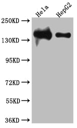 Western Blot | Positive WB detected in: Hela whole cell lysate, HepG2 whole cell lysate | All lanes: DNA Ligase I antibody at 1:1000 | Secondary | Goat polyclonal to rabbit IgG at 1/50000 dilution | Predicted band size: 102, 89, 99 kDa | Observed band size: 140 kDaLIG1 Recombinant Monoclonal Antibody