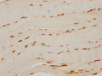IHC image of FTO Recombinant Monoclonal Antibody diluted at 1:70 and staining in paraffin-embedded human skeletal muscle tissue performed on a Leica BondTM system. After dewaxing and hydration, antigen retrieval was mediated by high pressure in a citrate buffer (pH 6.0). Section was blocked with 10% normal goat serum 30min at RT. Then primary antibody (1% BSA) was incubated at 4℃ overnight. The primary is detected by a biotinylated secondary antibody and visualized using an HRP conjugated SP system.FTO Recombinant Monoclonal Antibody