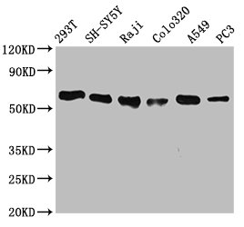 Western Blot | Positive WB detected in: 293T whole cell lysate, SH-SY5Y whole cell lysate, Raji whole cell lysate, Colo320 whole cell lysate, A549 whole cell lysate, PC3 whole cell lysate | All lanes: FTO antibody at 0.7μg/ml | Secondary | Goat polyclonal to rabbit IgG at 1/50000 dilution | Predicted band size: 59, 15, 7, 13 KDa | Observed band size: 59 KDaFTO Recombinant Monoclonal Antibody