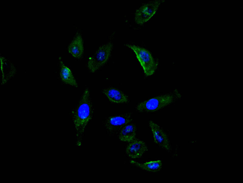 Immunofluorescence staining of A549 cell with ROBO1 Recombinant Monoclonal Antibody at 1:20, counter-stained with DAPI. The cells were fixed in 4% formaldehyde and blocked in 10% normal Goat Serum. The cells were then incubated with the antibody overnight at 4C. The secondary antibody was FITC-conjugated AffiniPure Goat Anti-Mouse IgG(H+L).ROBO1 Recombinant Monoclonal Antibody