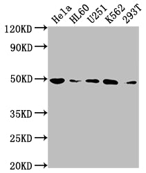 Western Blot | Positive WB detected in: Hela whole cell lysate, HL60 whole cell lysate, U251 whole cell lysate, K562 whole cell lysate, 293T whole cell lysate | All lanes: HDAC3 antibody at 1:2000 | Secondary | Goat polyclonal to rabbit IgG at 1/50000 dilution | Predicted band size: 49, 50 kDa | Observed band size: 49 kDaHDAC3 Recombinant Monoclonal Antibody