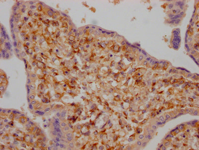 IHC image of LOXL2 Recombinant Monoclonal Antibody diluted at 1:100 and staining in paraffin-embedded human placenta tissue performed on a Leica BondTM system. After dewaxing and hydration, antigen retrieval was mediated by high pressure in a citrate buffer (pH 6.0). Section was blocked with 10% normal goat serum 30min at RT. Then primary antibody (1% BSA) was incubated at 4℃ overnight. The primary is detected by a Goat anti-rabbit IgG polymer labeled by HRP and visualized using 0.05% DAB.LOXL2 Recombinant Monoclonal Antibody