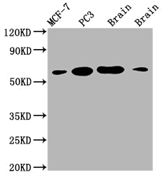 Western Blot | Positive WB detected in: MCF-7 whole cell lysate, PC3 whole cell lysate, Mouse brain tissue, Rat brain tissue | All lanes: LOXL2 antibody at 1:2000 | Secondary | Goat polyclonal to rabbit IgG at 1/50000 dilution | Predicted band size: 87 kDa | Observed band size: 53 kDaLOXL2 Recombinant Monoclonal Antibody