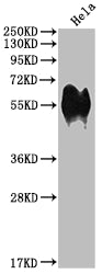 Western Blot | Positive WB detected in: Hela whole cell lysate | All lanes: CD46 antibody at 1:1000 | Secondary | Goat polyclonal to rabbit IgG at 1/50000 dilution | Predicted band size: 44, 45, 43, 41, 42, 40, 37 kDa | Observed band size: 56 kDa