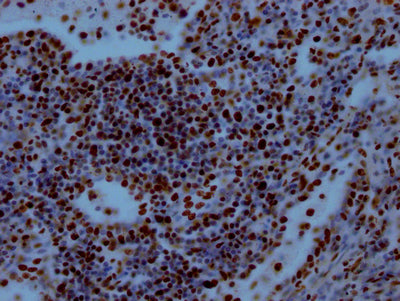 IHC image of RBBP4 Recombinant Monoclonal Antibody diluted at 1:100 and staining in paraffin-embedded human lung tissue performed on a Leica BondTM system. After dewaxing and hydration, antigen retrieval was mediated by high pressure in a citrate buffer (pH 6.0). Section was blocked with 10% normal goat serum 30min at RT. Then primary antibody (1% BSA) was incubated at 4℃ overnight. The primary is detected by a Goat anti-rabbit IgG polymer labeled by HRP and visualized using 0.05% DAB.RBBP4 Recombinant Monoclonal Antibody