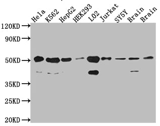 Western Blot | Positive WB detected in: Hela whole cell lysate, K562 whole cell lysate, HepG2 whole cell lysate, HEK293 whole cell lysate, L02 whole cell lysate, Jurkat whole cell lysate, SH-SY5Y whole cell lysate, Mouse Brain whole cell lysate, Rat Brain cell lysate | All lanes: RbAp48 antibody at 1:1000 | Secondary | Goat polyclonal to rabbit IgG at 1/50000 dilution | Predicted band size: 48, 48, 47, 44 kDa | Observed band size: 53, 40 kDaRBBP4 Recombinant Monoclonal Antibody