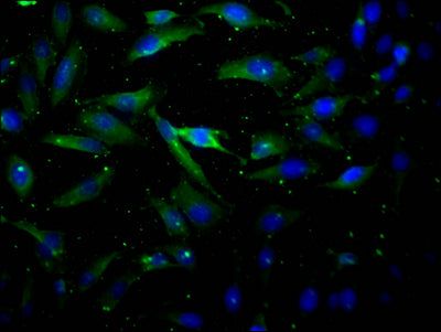 Immunofluorescence staining of Hela Cells with AKT1 Recombinant Monoclonal Antibody at 1:50, counter-stained with DAPI. The cells were fixed in 4% formaldehyde, permeated by 0.2% TritonX-100, and blocked in 10% normal Goat Serum. The cells were then incubated with the antibody overnight at 4℃. Nuclear DNA was labeled in blue with DAPI. The secondary antibody was FITC-conjugated AffiniPure Goat Anti-Rabbit IgG (H+L).AKT1 Recombinant Monoclonal Antibody
