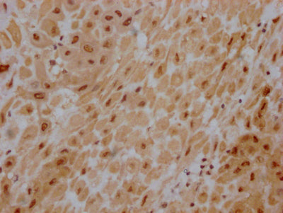 IHC image of AKT1 Recombinant Monoclonal Antibody diluted at 1:100 and staining in paraffin-embedded human placenta tissue performed on a Leica BondTM system. After dewaxing and hydration, antigen retrieval was mediated by high pressure in a citrate buffer (pH 6.0). Section was blocked with 10% normal goat serum 30min at RT. Then primary antibody (1% BSA) was incubated at 4℃ overnight. The primary is detected by a Goat anti-rabbit IgG polymer labeled by HRP and visualized using 0.05% DAB.AKT1 Recombinant Monoclonal Antibody