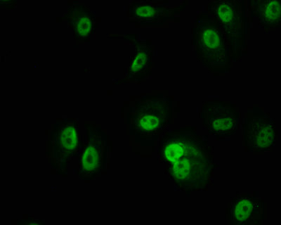 Immunofluorescence staining of MCF-7 cell with PKN2 Recombinant Monoclonal Antibody at 1:50, counter-stained with DAPI. The cells were fixed in 4% formaldehyde and blocked in 10% normal Goat Serum. The cells were then incubated with the antibody overnight at 4°C. The secondary antibody was Alexa Fluor 509-congugated AffiniPure Goat Anti-Rabbit IgG(H+L).PKN2 Recombinant Monoclonal Antibody