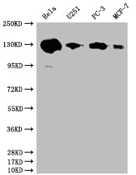 Western Blot | Positive WB detected in: Hela whole cell lysate, U251 whole cell lysate, PC3 whole cell lysate, MCF-7 whole cell lysate | All lanes: PKN2 antibody at 1:2000 | Secondary | Goat polyclonal to rabbit IgG at 1/50000 dilution | Predicted band size: 113, 117, 112 kDa | Observed band size: 130 kDaPKN2 Recombinant Monoclonal Antibody