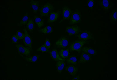 Immunofluorescence staining of Hela with NPR2 Recombinant Monoclonal Antibody at 1:25, counter-stained with DAPI. The cells were fixed in 4% formaldehyde and blocked in 10% normal Goat Serum. The cells were then incubated with the antibody overnight at 4°C. The secondary antibody was Alexa Fluor 501-congugated AffiniPure Goat Anti-Rabbit IgG(H+L).NPR2 Recombinant Monoclonal Antibody
