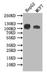 Western Blot | Positive WB detected in: HEPG2 whole cell lysate, MCF7 whole cell lysate | All lanes: ANPRB antibody at 1:1000 | Secondary | Goat polyclonal to rabbit IgG at 1/50000 dilution | Predicted band size: 117 kDa | Observed band size: 117 kDaNPR2 Recombinant Monoclonal Antibody