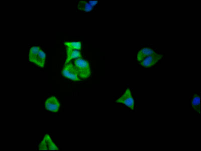 Immunofluorescence staining of Hela Cells with EIF5A Recombinant Monoclonal Antibody at 1:50, counter-stained with DAPI. The cells were fixed in 4% formaldehyde, permeated by 0.2% TritonX-100, and blocked in 10% normal Goat Serum. The cells were then incubated with the antibody overnight at 4℃. Nuclear DNA was labeled in blue with DAPI. The secondary antibody was FITC-conjugated AffiniPure Goat Anti-Rabbit IgG (H+L).
