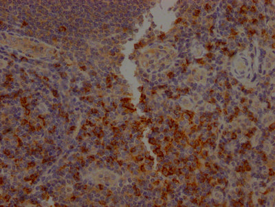 IHC image of CD8A Recombinant Monoclonal Antibody diluted at 1:100 and staining in paraffin-embedded human tonsil tissue performed on a Leica BondTM system. After dewaxing and hydration, antigen retrieval was mediated by high pressure in a citrate buffer (pH 6.0). Section was blocked with 10% normal goat serum 30min at RT. Then primary antibody (1% BSA) was incubated at 4℃ overnight. The primary is detected by a Goat anti-rabbit IgG polymer labeled by HRP and visualized using 0.05% DAB.