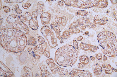 IHC image of FLT1 Recombinant Monoclonal Antibody diluted at 1:100 and staining in paraffin-embedded human placenta tissue performed on a Leica BondTM system. After dewaxing and hydration, antigen retrieval was mediated by high pressure in a citrate buffer (pH 6.0). Section was blocked with 10% normal goat serum 30min at RT. Then primary antibody (1% BSA) was incubated at 4°C overnight. The primary is detected by a Goat anti-rabbit polymer IgG labeled by HRP and visualized using 0.21% DAB.FLT1 Recombinant Monoclonal Antibody