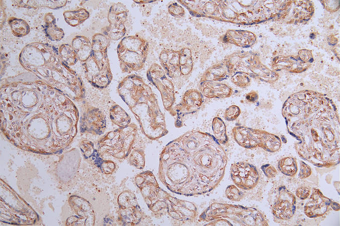 IHC image of FLT1 Recombinant Monoclonal Antibody diluted at 1:100 and staining in paraffin-embedded human placenta tissue performed on a Leica BondTM system. After dewaxing and hydration, antigen retrieval was mediated by high pressure in a citrate buffer (pH 6.0). Section was blocked with 10% normal goat serum 30min at RT. Then primary antibody (1% BSA) was incubated at 4°C overnight. The primary is detected by a Goat anti-rabbit polymer IgG labeled by HRP and visualized using 0.21% DAB.FLT1 Recombinant Monoclonal Antibody