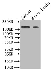 Western Blot | Positive WB detected in: JK whole cell lysate, Mouse Brain tissue lysate | All lanes: VEGF Receptor 1 antibody at 1:500 | Secondary | Goat polyclonal to rabbit IgG at 1/50000 dilution | Predicted band size: 150 kDa | Observed band size: 150 kDaFLT1 Recombinant Monoclonal Antibody