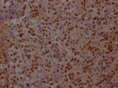IHC image of ISL1 Recombinant Monoclonal Antibody diluted at 1:100 and staining in paraffin-embedded human adrenal gland tissue performed on a Leica BondTM system. After dewaxing and hydration, antigen retrieval was mediated by high pressure in a citrate buffer (pH 6.0). Section was blocked with 10% normal goat serum 30min at RT. Then primary antibody (1% BSA) was incubated at 4℃ overnight. The primary is detected by a Goat anti-rabbit IgG polymer labeled by HRP and visualized using 0.05% DAB.ISL1 Recombinant Monoclonal Antibody