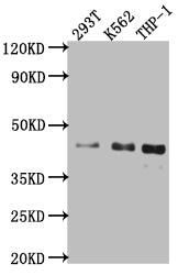 Western Blot | Positive WB detected in: 293T whole cell lysate, K562 whole cell lysate, THP-1 whole cell lysate | All lanes: Islet1 antibody at 1:1000 | Secondary | Goat polyclonal to rabbit IgG at 1/50000 dilution | Predicted band size: 40 kDa | Observed band size: 40 kDaISL1 Recombinant Monoclonal Antibody