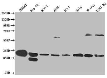Western Blot | Positive WB detected in: Jurkat whole cell lysate, HepG2 whole cell lysate, MCF-7 whole cell lysate, A549 whole cell lysate, PC3 whole cell lysate, Hela whole cell lysate, Ntera-2 whole cell lysate, U251 whole cell lysate | All lanes: PSME1 antibody at 1:2000 | Secondary | Goat polyclonal to rabbit IgG at 1/50000 dilution | Predicted band size: 29, 27 kDa | Observed band size: 28-30, 55-72 kDaPSME1 Recombinant Monoclonal Antibody