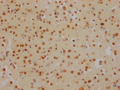 IHC image of HDAC2 Recombinant Monoclonal Antibody diluted at 1:100 and staining in paraffin-embedded human brain tissue performed on a Leica BondTM system. After dewaxing and hydration, antigen retrieval was mediated by high pressure in a citrate buffer (pH 6.0). Section was blocked with 10% normal goat serum 30min at RT. Then primary antibody (1% BSA) was incubated at 4℃ overnight. The primary is detected by a Goat anti-rabbit IgG polymer labeled by HRP and visualized using 0.05% DAB.HDAC2 Recombinant Monoclonal Antibody