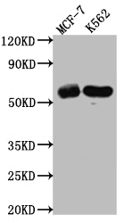 Western Blot | Positive WB detected in: MCF-7 whole cell lysate, K562 whole cell lysate | All lanes: HDAC2 antibody at 1:1000 | Secondary | Goat polyclonal to rabbit IgG at 1/50000 dilution | Predicted band size: 56, 52 kDa | Observed band size: 60 kDaHDAC2 Recombinant Monoclonal Antibody