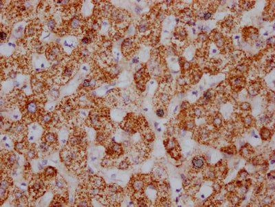 IHC image of HSPD1 Recombinant Monoclonal Antibody diluted at 1:100 and staining in paraffin-embedded human liver tissue performed on a Leica BondTM system. After dewaxing and hydration, antigen retrieval was mediated by high pressure in a citrate buffer (pH 6.0). Section was blocked with 10% normal goat serum 30min at RT. Then primary antibody (1% BSA) was incubated at 4℃ overnight. The primary is detected by a Goat anti-rabbit IgG polymer labeled by HRP and visualized using 0.05% DAB.HSPD1 Recombinant Monoclonal Antibody