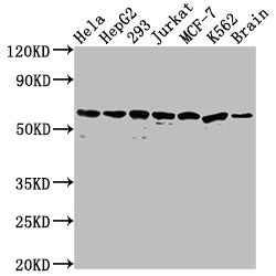 Western Blot | Positive WB detected in: Hela whole cell lysate, HepG2 whole cell lysate, 293 whole cell lysate, Jurkat whole cell lysate, MCF-7 whole cell lysate, K562 whole cell lysate, Mouse brain tissue | All lanes: HSPD1 antibody at 1:2000 | Secondary | Goat polyclonal to rabbit IgG at 1/50000 dilution | Predicted band size: 62, 18 kDa | Observed band size: 60 kDaHSPD1 Recombinant Monoclonal Antibody