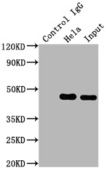 Immunoprecipitating MAP2K1 in Hela whole cell lysate | Lane 1: Rabbit control IgG instead of MAP2K1 Recombinant Monoclonal Antibody in Hela whole cell lysate. | For western blotting,a HRP-conjugated Protein G antibody was used as the secondary antibody (1/2000) | Lane 2: MAP2K1 Recombinant Monoclonal Antibody(2µg)+ Hela whole cell lysate(500µg) | Lane 3: Hela whole cell lysate (10µg)MAP2K1 Recombinant Monoclonal Antibody