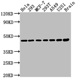 Western Blot | Positive WB detected in: Hela whole cell lysate, 293 whole cell lysate, MCF-7 whole cell lysate, 293T whole cell lysate, A549 whole cell lysate, U251 whole cell lysate, Rat brain tissue | All lanes: MAP2K1 antibody at 1:2000 | Secondary | Goat polyclonal to rabbit IgG at 1/50000 dilution | Predicted band size: 44, 41 kDa | Observed band size: 44 kDaMAP2K1 Recombinant Monoclonal Antibody
