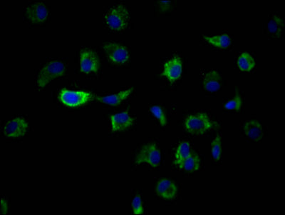 Immunofluorescence staining of MCF7 Cells with ILK Recombinant Monoclonal Antibody at 1:50, counter-stained with DAPI. The cells were fixed in 4% formaldehyde and blocked in 10% normal Goat Serum. The cells were then incubated with the antibody overnight at 4℃. Nuclear DNA was labeled in blue with DAPI. The secondary antibody was FITC-conjugated AffiniPure Goat Anti-Rabbit IgG (H+L).ILK Recombinant Monoclonal Antibody