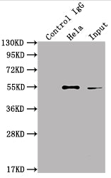 Immunoprecipitating ILK in Hela whole cell lysate | Lane 1: Rabbit control IgG instead of ILK Recombinant Monoclonal Antibody in Hela whole cell lysate. | For western blotting,a HRP-conjugated Protein G antibody was used as the secondary antibody (1/2000) | Lane 2: ILK Recombinant Monoclonal Antibody(2µg)+ Hela whole cell lysate(500µg) | Lane 3: Hela whole cell lysate (10µg)ILK Recombinant Monoclonal Antibody