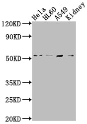 Western Blot | Positive WB detected in: Hela whole cell lysate, HL60 whole cell lysate, A549 whole cell lysate, Mouse kidney tissue | All lanes: ILK antibody at 1:2000 | Secondary | Goat polyclonal to rabbit IgG at 1/50000 dilution | Predicted band size: 52, 45, 37 kDa | Observed band size: 51 kDaILK Recombinant Monoclonal Antibody