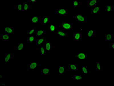 Immunofluorescence staining of Hela Cells with CCNE1 Recombinant Monoclonal Antibody at 1:50, counter-stained with DAPI. The cells were fixed in 4% formaldehyde, permeated by 0.2% TritonX-100, and blocked in 10% normal Goat Serum. The cells were then incubated with the antibody overnight at 4℃. Nuclear DNA was labeled in blue with DAPI. The secondary antibody was FITC-conjugated AffiniPure Goat Anti-Rabbit IgG (H+L).
