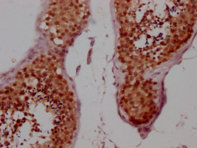 IHC image of CCNE1 Recombinant Monoclonal Antibody diluted at 1:100 and staining in paraffin-embedded human testis tissue performed on a Leica BondTM system. After dewaxing and hydration, antigen retrieval was mediated by high pressure in a citrate buffer (pH 6.0). Section was blocked with 10% normal goat serum 30min at RT. Then primary antibody (1% BSA) was incubated at 4℃ overnight. The primary is detected by a Goat anti-rabbit IgG polymer labeled by HRP and visualized using 0.05% DAB.
