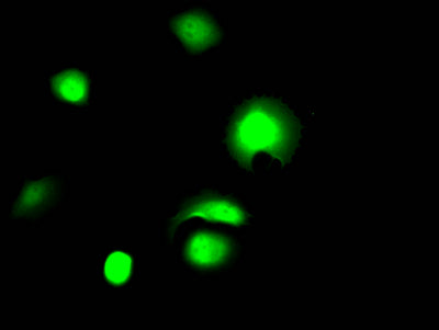 Immunofluorescence staining of MCF7 Cells with LGALS3 Recombinant Monoclonal Antibody at 1:50, counter-stained with DAPI. The cells were fixed in 4% formaldehyde, permeated by 0.2% TritonX-100, and blocked in 10% normal Goat Serum. The cells were then incubated with the antibody overnight at 4℃. Nuclear DNA was labeled in blue with DAPI. The secondary antibody was FITC-conjugated AffiniPure Goat Anti-Rabbit IgG (H+L).LGALS3 Recombinant Monoclonal Antibody
