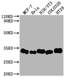 Western Blot | Positive WB detected in: MCF-7 whole cell lysate, Hela whole cell lysate, NIH/3T3 whole cell lysate, Colo320 whole cell lysate, HT29 whole cell lysate | All lanes: Galectin 3 antibody at 1:2000 | Secondary | Goat polyclonal to rabbit IgG at 1/50000 dilution | Predicted band size: 27 kDa | Observed band size: 31 kDaLGALS3 Recombinant Monoclonal Antibody
