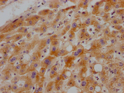 IHC image of the antibody diluted at 1:100 and staining in paraffin-embedded human liver tissue performed on a Leica BondTM system. After dewaxing and hydration, antigen retrieval was mediated by high pressure in a citrate buffer (pH 6.0). Section was blocked with 10% normal goat serum 30min at RT. Then primary antibody (1% BSA) was incubated at 4℃ overnight. The primary is detected by a Goat anti-rabbit IgG polymer labeled by HRP and visualized using 0.05% DAB.