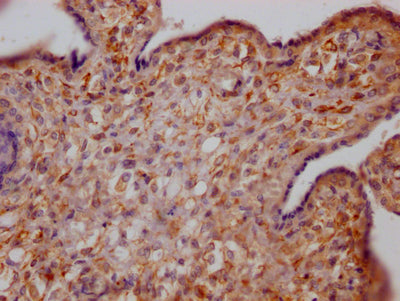 IHC image of GHR Recombinant Monoclonal Antibody diluted at 1:100 and staining in paraffin-embedded human placenta tissue performed on a Leica BondTM system. After dewaxing and hydration, antigen retrieval was mediated by high pressure in a citrate buffer (pH 6.0). Section was blocked with 10% normal goat serum 30min at RT. Then primary antibody (1% BSA) was incubated at 4℃ overnight. The primary is detected by a Goat anti-rabbit IgG polymer labeled by HRP and visualized using 0.05% DAB.
