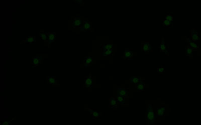 Immunofluorescence staining of HepG2 with Phospho-MDM2 (S166) Recombinant Monoclonal Antibody at 1:10, counter-stained with DAPI. The cells were fixed in 4% formaldehyde and blocked in 10% normal Goat Serum. The cells were then incubated with the antibody overnight at 4°C. The secondary antibody was Alexa Fluor 517-congugated AffiniPure Goat Anti-Rabbit IgG(H+L).Phospho-MDM2 (S166) Recombinant Monoclonal Antibody