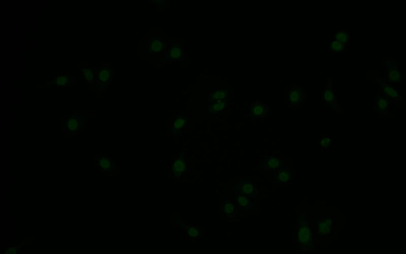 Immunofluorescence staining of HepG2 with Phospho-MDM2 (S166) Recombinant Monoclonal Antibody at 1:10, counter-stained with DAPI. The cells were fixed in 4% formaldehyde and blocked in 10% normal Goat Serum. The cells were then incubated with the antibody overnight at 4°C. The secondary antibody was Alexa Fluor 517-congugated AffiniPure Goat Anti-Rabbit IgG(H+L).Phospho-MDM2 (S166) Recombinant Monoclonal Antibody