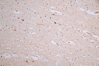 IHC image of the antibody diluted at 1:50 and staining in paraffin-embedded human brain tissue performed on a Leica BondTM system. After dewaxing and hydration, antigen retrieval was mediated by high pressure in a citrate buffer (pH 6.0). Section was blocked with 10% normal goat serum 30min at RT. Then primary antibody (1% BSA) was incubated at 4°C overnight. The primary is detected by a Goat anti-rabbit polymer IgG labeled by HRP and visualized using 0.57% DAB.Phospho-MDM2 (S166) Recombinant Monoclonal Antibody