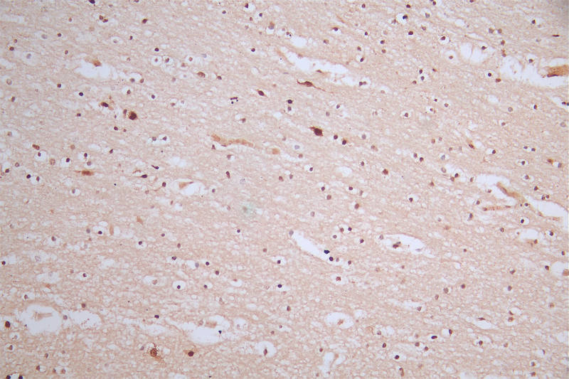 IHC image of the antibody diluted at 1:50 and staining in paraffin-embedded human brain tissue performed on a Leica BondTM system. After dewaxing and hydration, antigen retrieval was mediated by high pressure in a citrate buffer (pH 6.0). Section was blocked with 10% normal goat serum 30min at RT. Then primary antibody (1% BSA) was incubated at 4°C overnight. The primary is detected by a Goat anti-rabbit polymer IgG labeled by HRP and visualized using 0.57% DAB.Phospho-MDM2 (S166) Recombinant Monoclonal Antibody