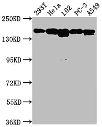 Western Blot | Positive WB detected in: 293T whole cell lysate, Hela whole cell lysate, L02 whole cell lysate, PC-3 whole cell lysate, A549 whole cell lysate | All lanes: MET antibody at 1:1500 | Secondary | Goat polyclonal to rabbit IgG at 1/50000 dilution | Predicted band size: 156, 158, 86 kDa | Observed band size: 156 kDaMET Recombinant Monoclonal Antibody